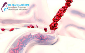 bleeding problem related best lady doctor in jaipur