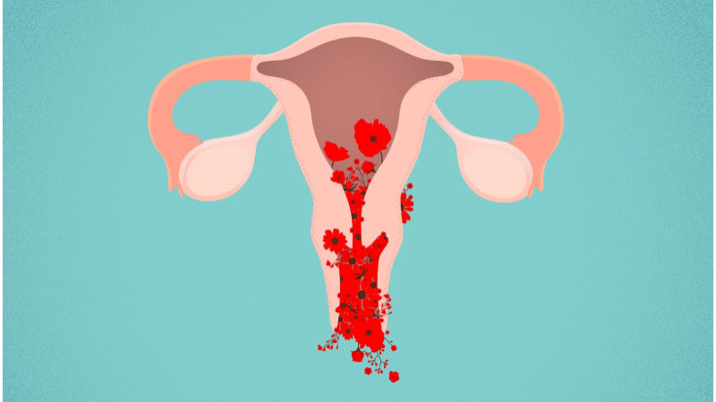 Uterine-Bleeding uterine bleeding problem treatment in Jaipur